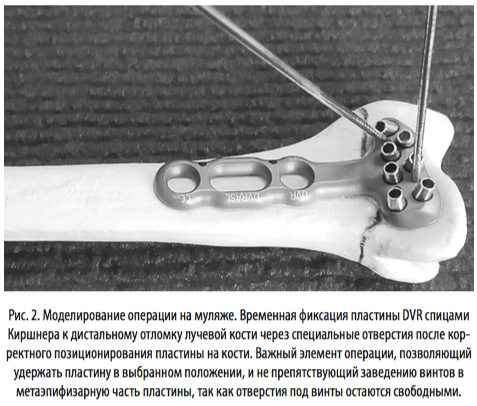 рис2