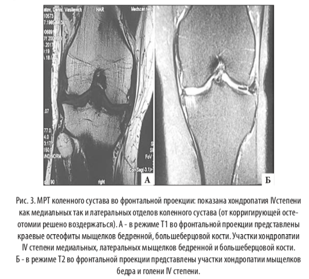 рис3