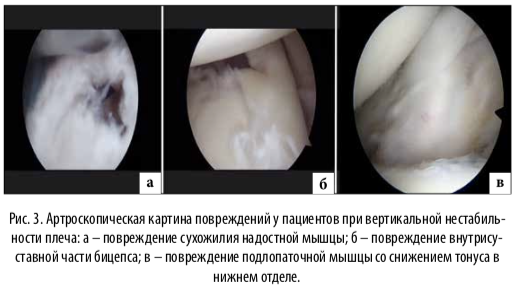 рис3