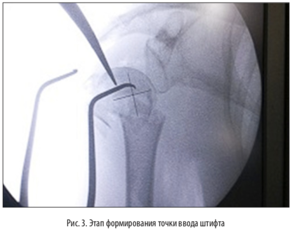 рис3