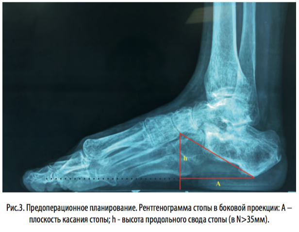 рис3