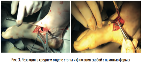 рис3