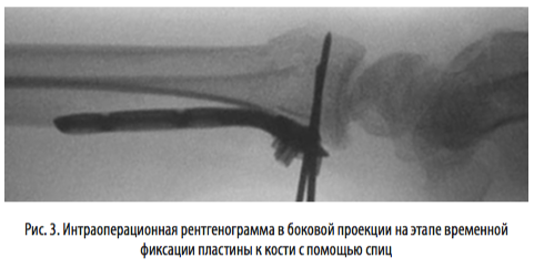 рис3