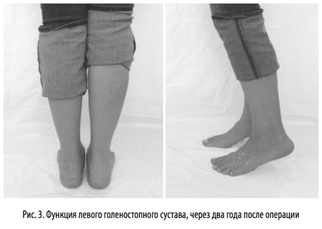 рис3