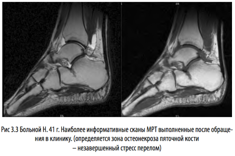 рис3 3