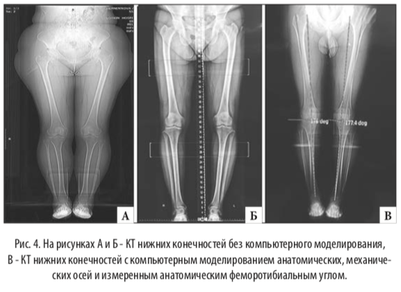 рис4