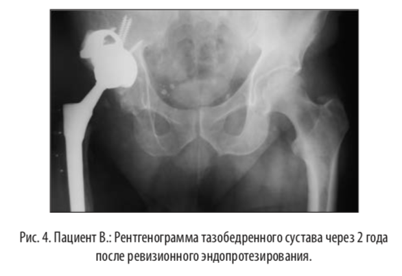 рис4