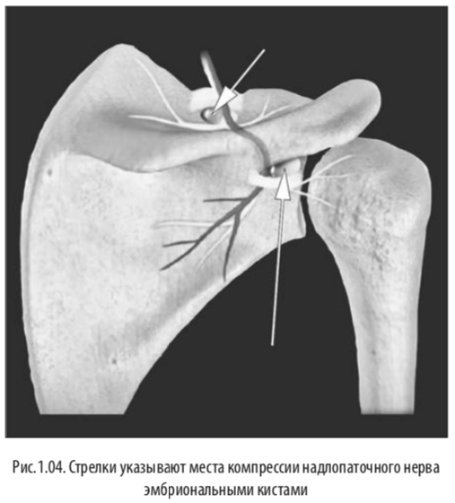 рис4