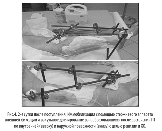 рис4