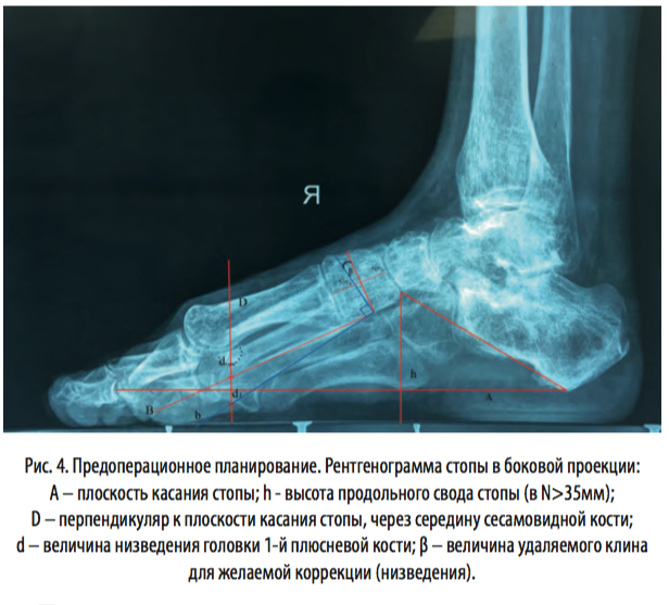 рис4