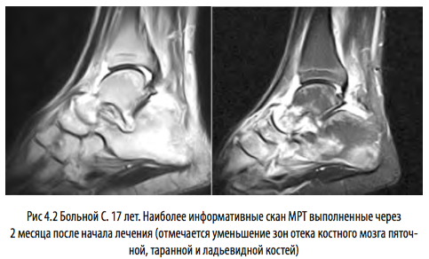 рис4 2
