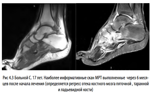рис4 3