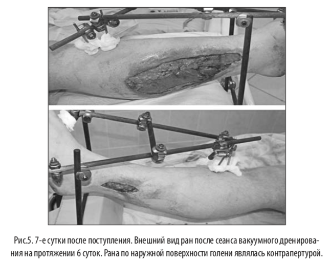 рис5