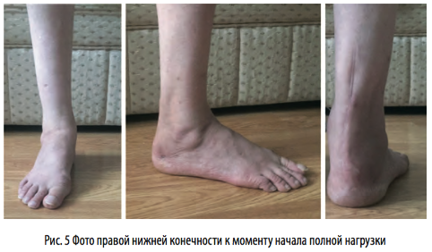 рис5