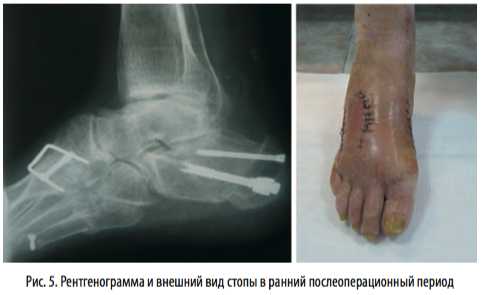 рис5
