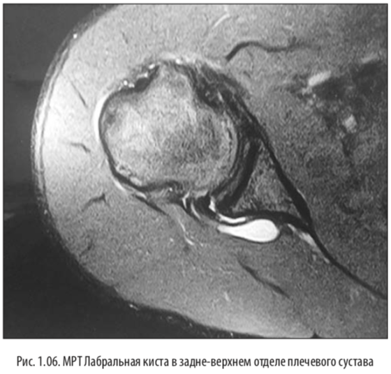 рис6