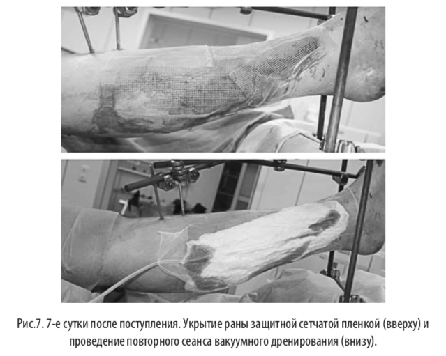 рис7