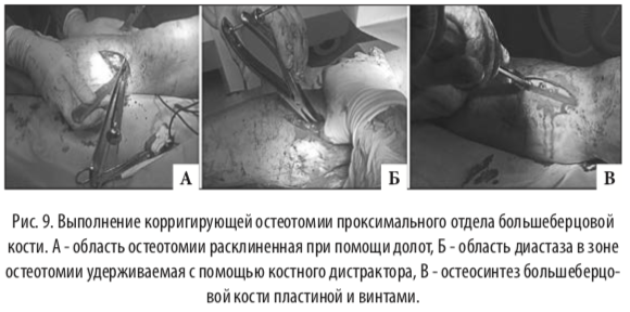 рис9