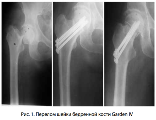 рис 1