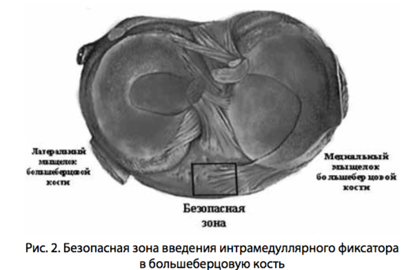 рис 2