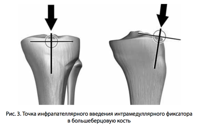 рис 3