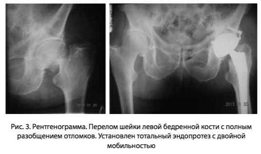 рис 3