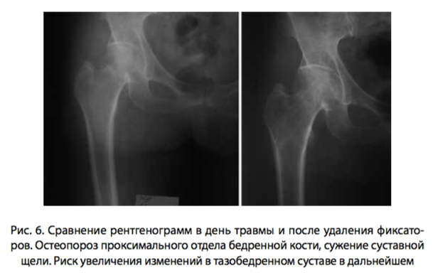 рис 6