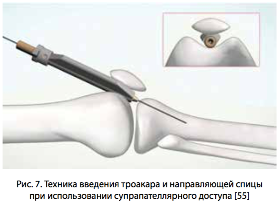 рис 7