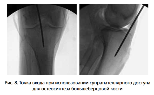 рис 8